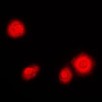 Polyclonal Rabbit anti-Human NFKB1 / NF-Kappa-B Antibody (Internal, IHC, IF, WB)