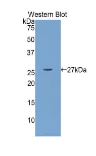 MYLK Antibody (aa1684-1884, Cy3)