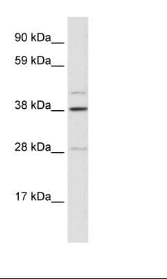 Polyclonal Rabbit anti-Human LASS3 Antibody (aa54-103, WB)