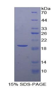 Dog ADM / Adrenomedullin Protein (Recombinant His)