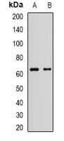 MLLT3 / AF9 Antibody