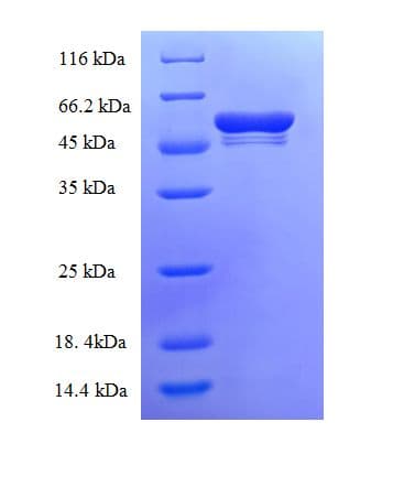 Tpsb2 / Tryptase Beta 2 (Mouse Protein (Recombinant GST)