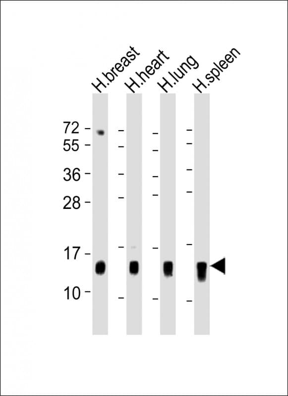 S100A9 / MRP14 Antibody (aa22-56)