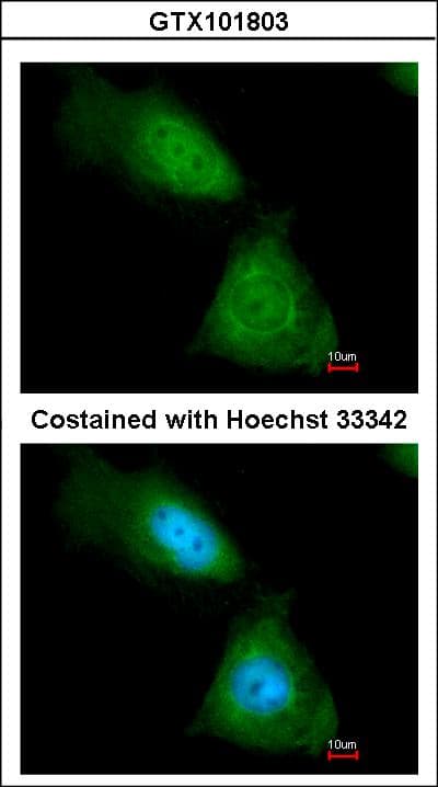 PathPlus™ Polyclonal Rabbit anti-Human ENO1 / Alpha Enolase Antibody (aa199-434, IHC, WB)