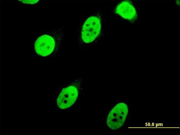 IHC-plus™ CBFA1 / RUNX2 Antibody (clone 1D8)