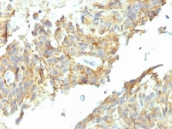 Monoclonal Mouse anti-Human Alkaline Phosphatase Antibody (clone ALPL/597, Ready-to-Use, IHC)
