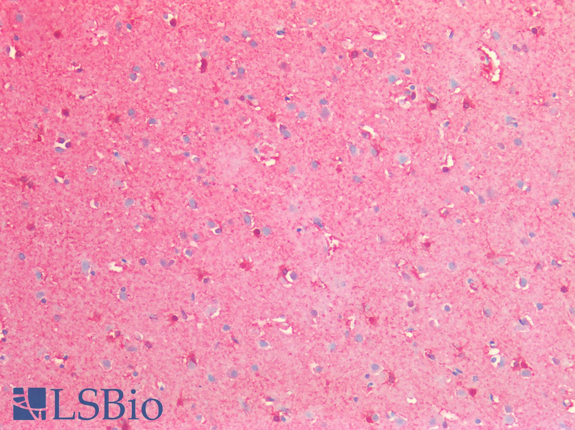 PathPlus™ ENO1 / Alpha Enolase Antibody