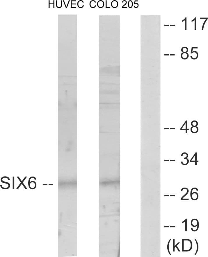 Polyclonal Rabbit anti-Human SIX6 Antibody (aa121-170, IF, WB)