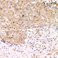 ACP1 / Acid Phosphatase Antibody