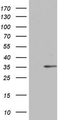 C14orf166 Antibody (clone OTI2B5)