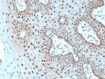 MYC / c-Myc Antibody (clone MYC275 + MYC909)