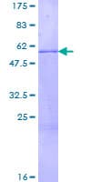 Human STAR Protein (Recombinant GST)