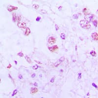 ATF3 Antibody (C-Terminus)