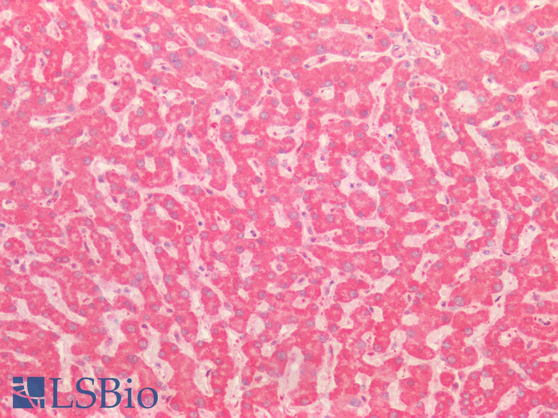 PathPlus™ Polyclonal Rabbit anti-Human BECN1 / Beclin-1 Antibody (N-Terminus, IHC, WB)