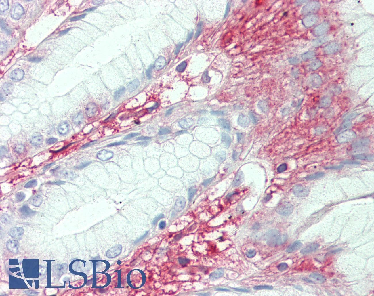 IHC-plus™ SLC7A2 Antibody (Internal)