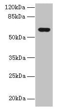 KATNAL2 Antibody