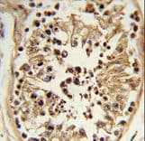 CHPF / CHSY2 Antibody (aa327-354)