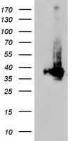 Monoclonal Mouse anti-Human ARH / LDLRAP1 Antibody (clone OTI4B10, IHC, WB)