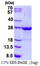 Human ULBP1 Protein (Recombinant His)