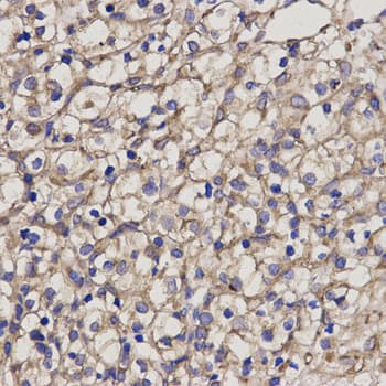 Polyclonal Rabbit anti-Human PRF1 / Perforin Antibody (IHC, IF, WB)