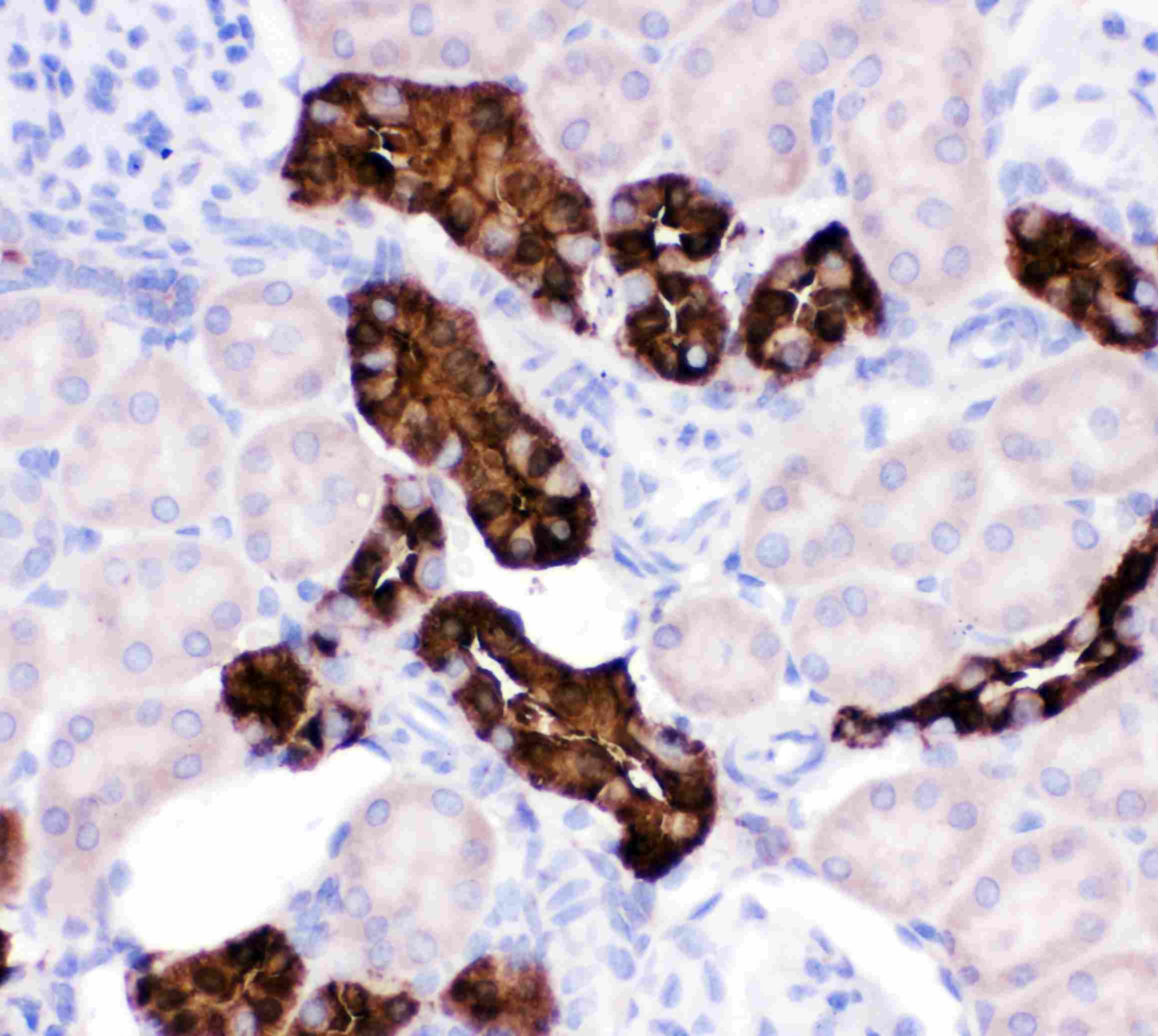 CALB1 / Calbindin Antibody (aa2-175)