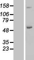 ABAT Protein (Over-Expression Lysate Myc-DDK (Flag))