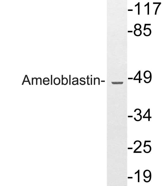 Polyclonal Rabbit anti-Human Ameloblastin / AMBN Antibody (aa275-324, WB)