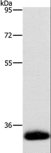 AMBP Antibody