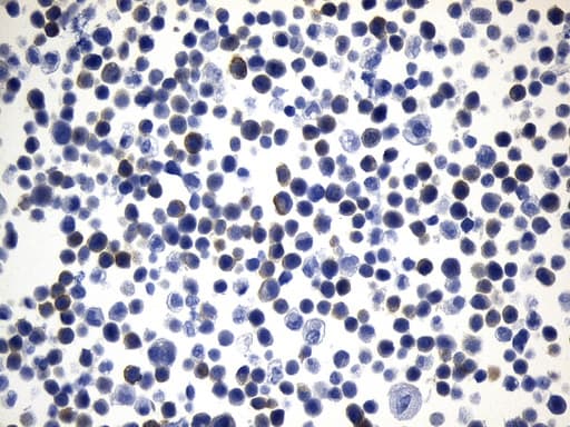 Monoclonal Mouse anti-Human MAPT / Tau Antibody (clone UMAB239, aa623-758, IHC, WB)