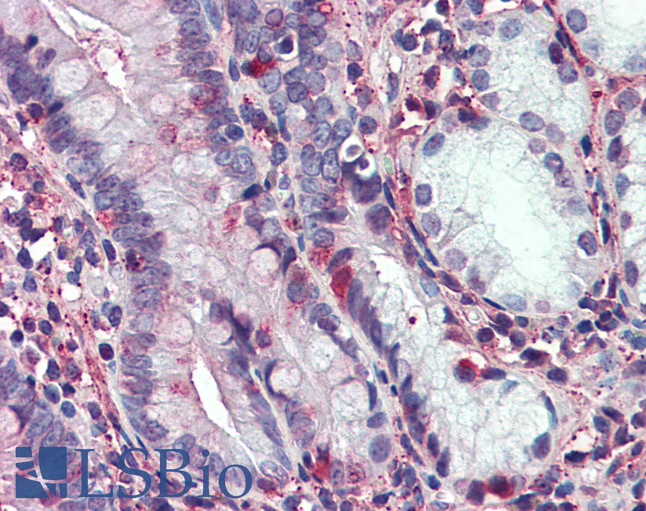 IHC-plus™ Polyclonal Rabbit anti-Human THEM6 / C8orf55 Antibody (Internal, IHC)
