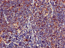 Polyclonal Rabbit anti-Human C1orf177 Antibody (IHC, WB)