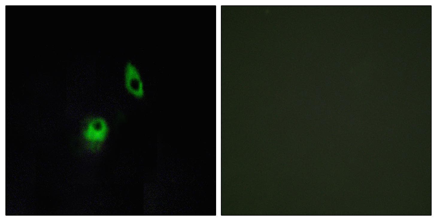 ADGRA2 / GPR124 Antibody