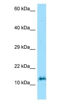 ORMDL3 Antibody (N-Terminus)