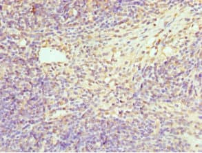 HPS / HPS1 Antibody