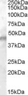 IHC-plus™ KCNJ11 / Kir6.2 Antibody (aa30-42)