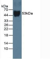 GC / Vitamin D-Binding Protein Antibody (clone C1, APC)