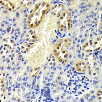 Polyclonal Rabbit anti-Human CDKN1B / p27 Kip1 Antibody (IHC, IF, WB)