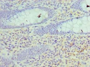 HSD17B4 Antibody (aa437-736)