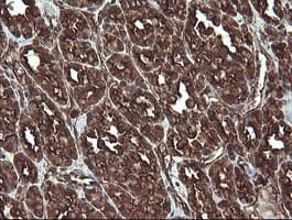REEP5 Antibody (clone OTI4D2)