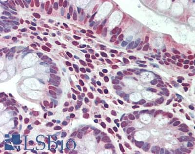 IHC-plus™ STRA13 Antibody