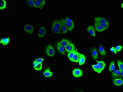 Polyclonal Rabbit anti-Human SFT2D2 Antibody