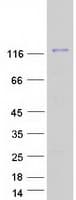 Human USP16 Protein (Recombinant Myc-DDK (Flag))