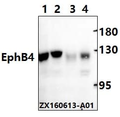 IHC-plus™ EPHB4 / EPH Receptor B4 Antibody (aa580-630)