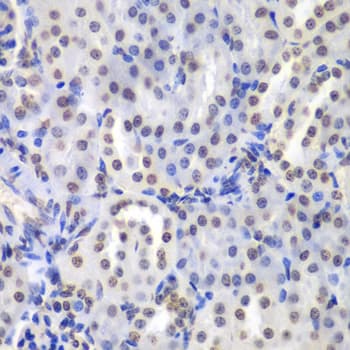 PRKCB / PKC-Beta Antibody