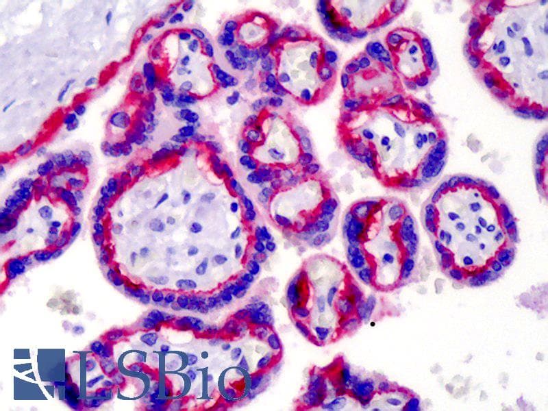 IHC-plus™ ITGB4 / Integrin Beta 4 Antibody (clone 439-9B)