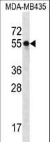 SLC15A3 Antibody (aa168-197)