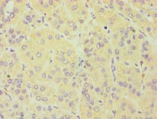 CYGB / Cytoglobin Antibody (aa1-190)