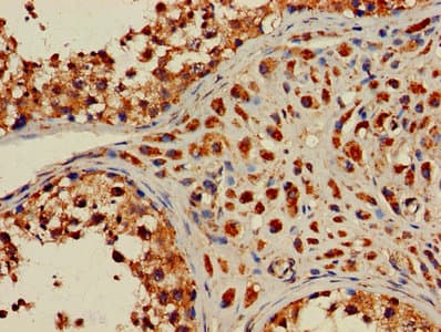 HIST2H2AC Antibody