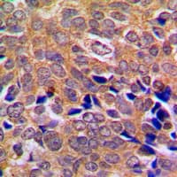 ABL Antibody (C-Terminus)