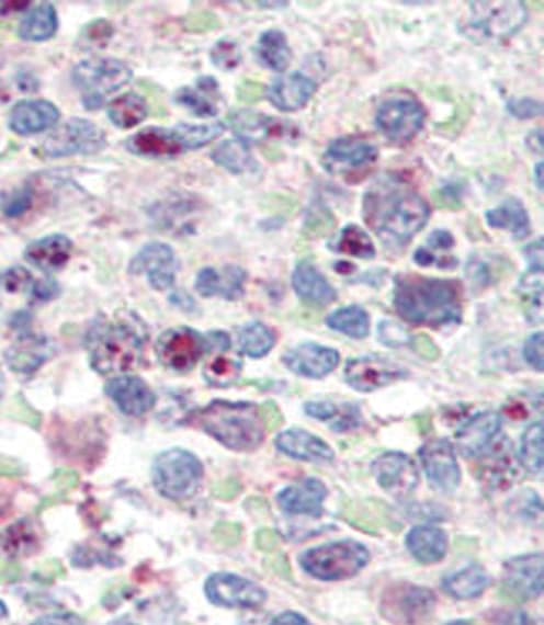 Polyclonal Rabbit anti-Human SNAI1 / SNAIL-1 Antibody (aa9-39, IHC, WB)
